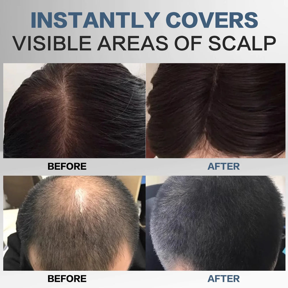 Instantly Hairline Shadow-Hair Shadow Powder, Quick Cover Black Hair Root Concealer, Eyebrows & Beard Line,Unisex,Black